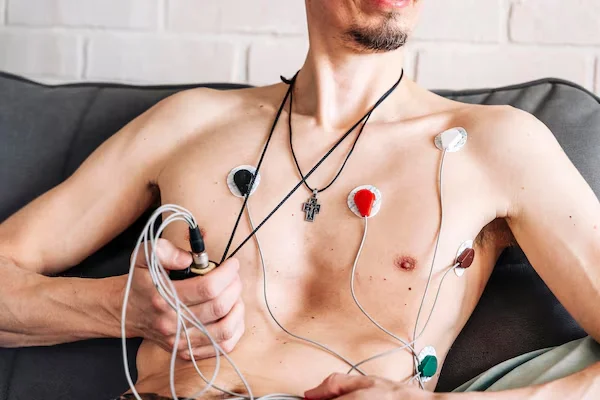 Holter Monitoring